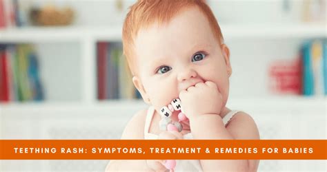 Teething Rash: Symptoms, Treatment & Remedies for Babies