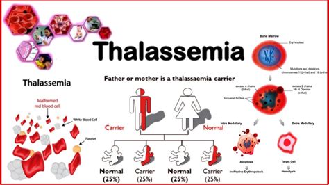 Pathophysiology Of Alpha Thalassemia