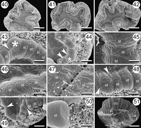 Tupidanthus calyptratus, androecium development. 40-42 Variation in... | Download Scientific Diagram