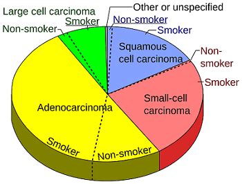 Lung Cancer Treatment Cost in India, Lung Cancer Surgery Cost in India