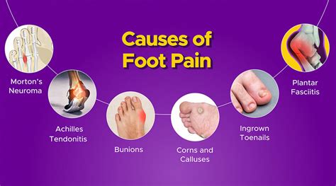 What are the most common causes of foot pain? - MyFrido