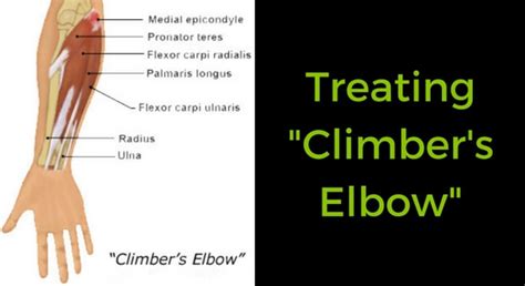 Treating Tendonitis/Tendinosis for Climbers - TrainingBeta