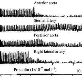 Diagram of heart of lobster to show ostia and arterial valves and ...