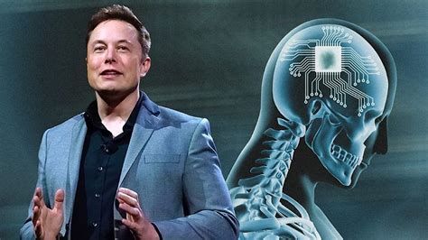 US FDA Gives Approval To Elon Musk Neuralink For Human Trials