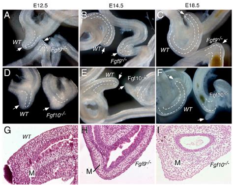 The development of the cecum is abnormal in both Fgf9 − / − and Fgf10 −... | Download Scientific ...