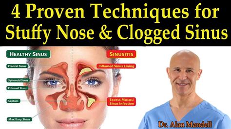 Sinus Medication For Blocked Ears at trevorrstoweo blog