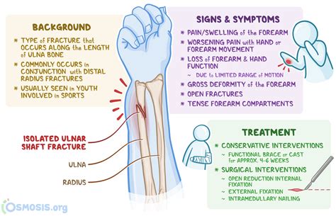 Distal Ulna Fracture: What Is It, Management, and More | Osmosis