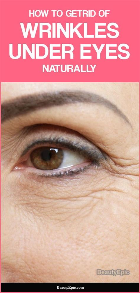 How to Get Rid of Under Eye Wrinkles Naturally | Eye wrinkle, Under eye wrinkles, Undereye