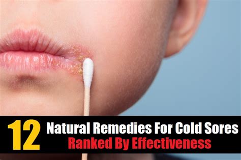 12 Home Remedies For Cold Sores Ranked By Effectiveness