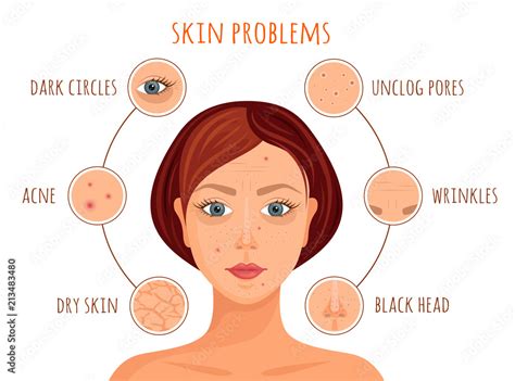 Types of skin problems. Vector illustration. Information banner on the ...