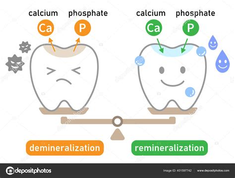 Cute Tooth Demineralization Remineralization Balance Scale Dental Care Concept Stock Vector ...