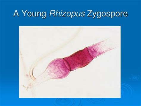 Zygospore Fungi Examples