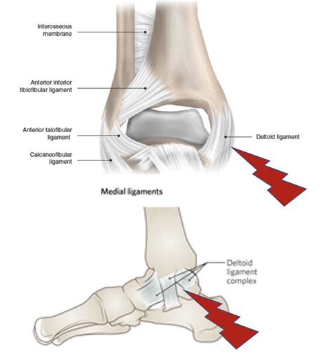 Deltoid Ligament