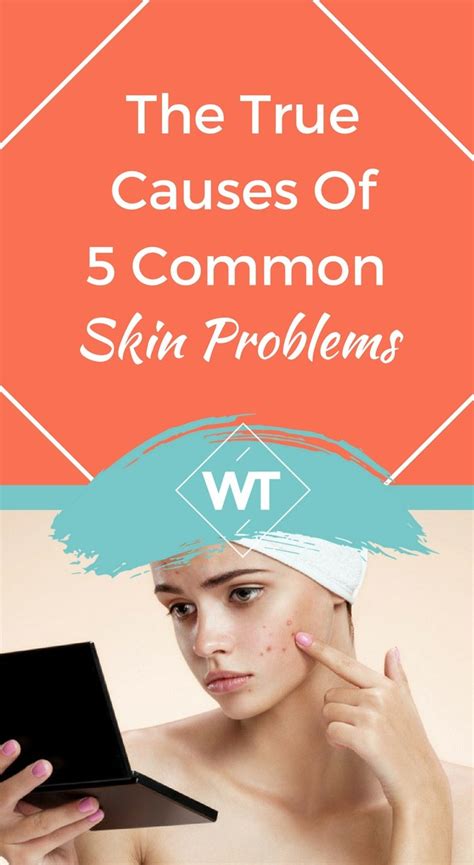 The True Causes Of 5 Common Skin Problems