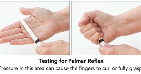 Whole-Brain Living and Learning: Understanding the Palmar (Hand) Reflex - and the “Grasp ...