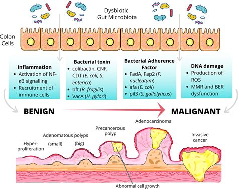 Frontiers | Colon Carcinogenesis: The Interplay Between Diet and Gut Microbiota