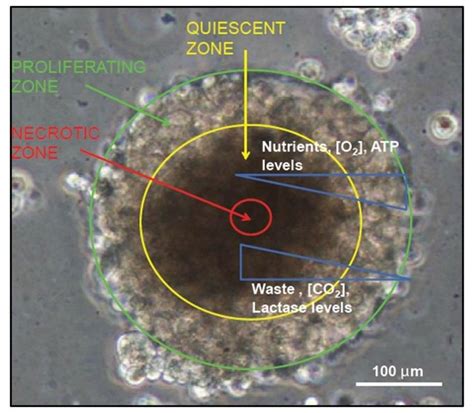 Schematic diagram of a tumor spheroid. Different zones and the... | Download Scientific Diagram