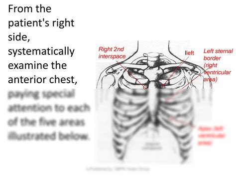 SOLUTION: Heart heart vessels apex beat and percussion and auscultation ...