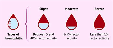 Types of haemophilia according to their severity