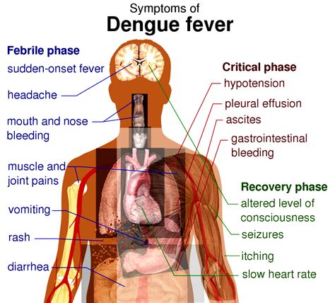 Home Remedies for Dengue Fever -Top 10 Home Remedies | ArticleCube