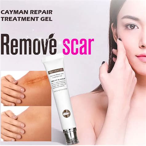 Cayman Acne Scar Removal Cream Skin Repair Face Cream Acne Spots Acne Treatment Blackhead ...