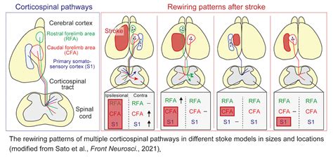 Corticospinal Tract Pathway