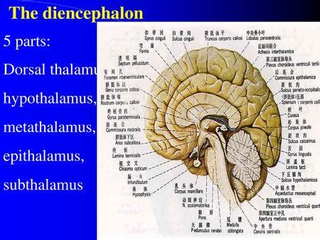 Epithalamus Diagram