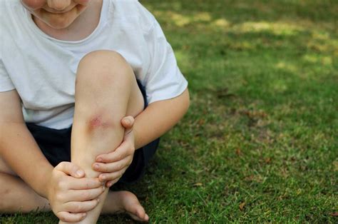 First aid care for cuts, scrapes, & bumps - FamilyEducation