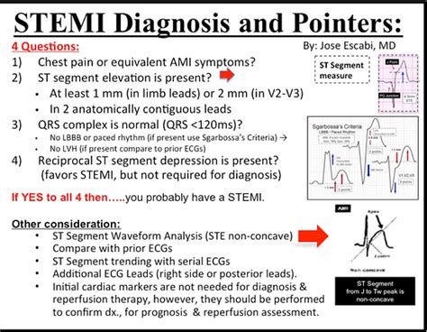 Mastering STEMI ECG