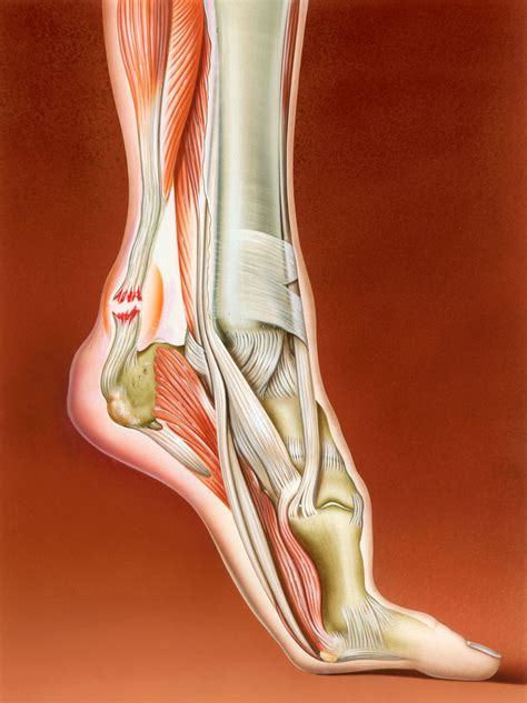 Why Kevin Durant's Achilles Tendon Was His Achilles' Heel | WIRED