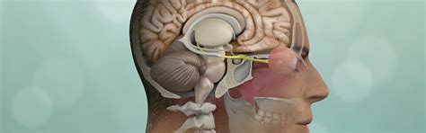 Minimally Invasive Brain Surgery | Keyhole Craniotomy | Pacific Brain Tumor Center