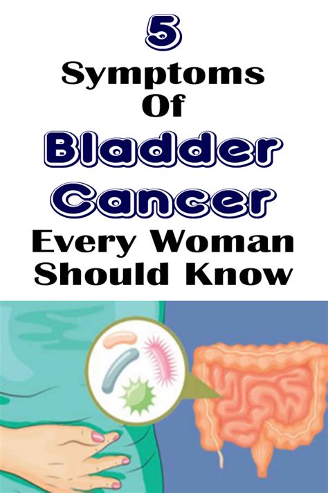 5 Symptoms Of Bladder Cancer Every Woman Should Know - Healthy Lifestyle