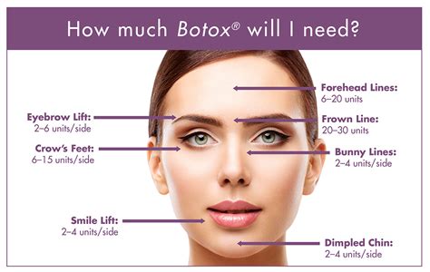 Botox - Argyle Med Spa & Wellness Center