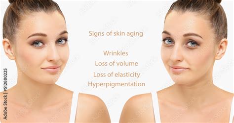 Ageing skin ,internal and external causes of skin aging, signs of skin aging Stock Photo | Adobe ...