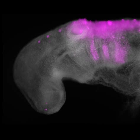 Development and evolution of the neural crest — The Gillis Lab