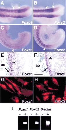 The murine winged helix transcription factors, Foxc1 and Foxc2, are both required for ...