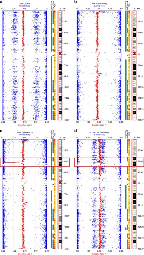 SNP array analysis of X chromosomes in representative ONB tumor... | Download Scientific Diagram