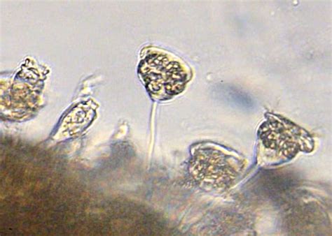 Stalked Ciliate, Vorticella