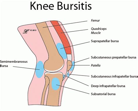 Knee Bursitis - Mississauga Chiropractor and Physiotherapy Clinic - FREE Consult!