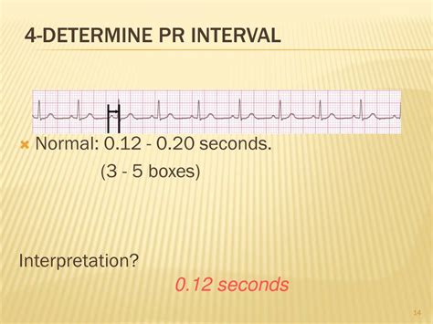 PPT - ELECTROCARDIOGRAM (ECG) PowerPoint Presentation, free download - ID:5673130