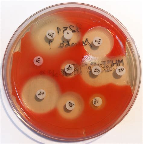 Serratia marcescens - Quip Labs