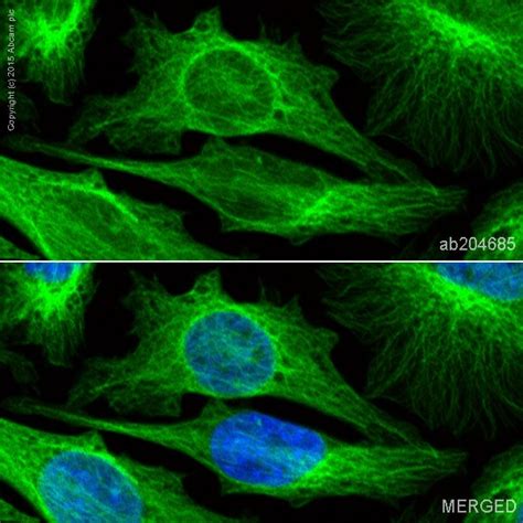 Alexa Fluor® 488 Anti-beta Tubulin antibody [EPR16774] (ab204685) | Abcam