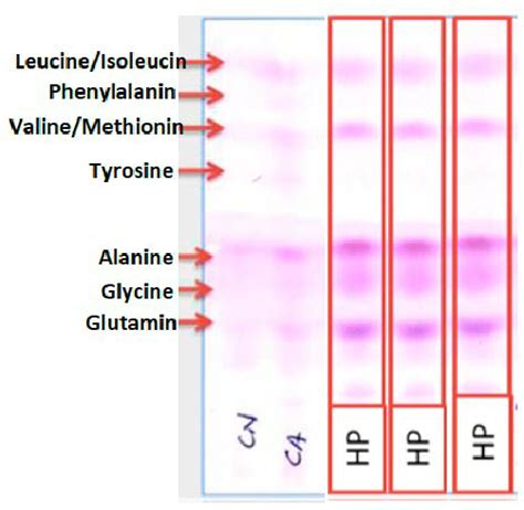 Amino Acid Chromatography