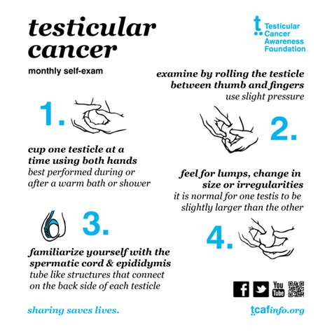 Common Causes of Testicular Lumps and Swellings - London Andrology