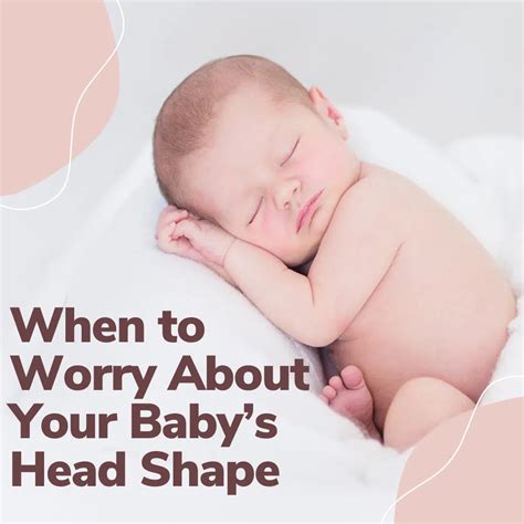 When to Worry About Your Baby’s Head Shape - Noodle Soup