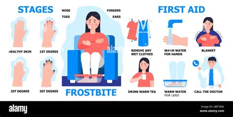 Frostbite first aid info-graphic vector. Girl is warming hand in water. Hypothermia in winter ...