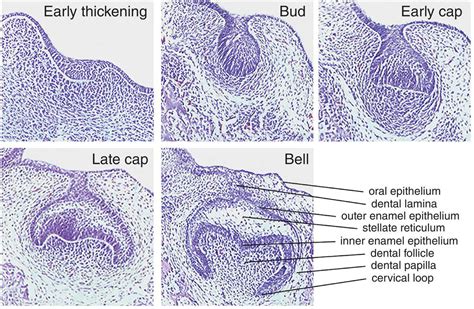 3: Tooth development | Pocket Dentistry