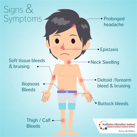 Symptoms of Hemophila - Health Tips from Kokilaben Hospital