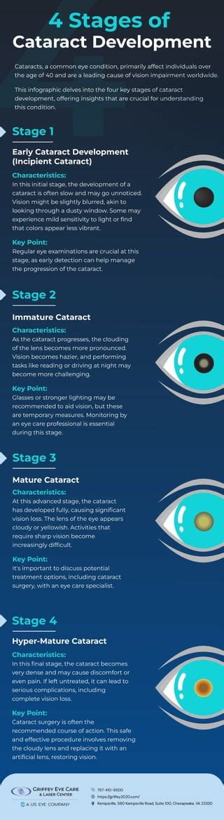 4 Stages of Cataract Development | PDF