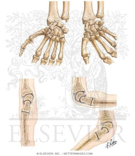 Movements at Wrist Joint Movements of the Wrist Movements of Wrist